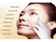 上海美容醫院去疤痕好的產品是什么