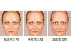 女人25歲后上海美萊如何來抗衰除皺