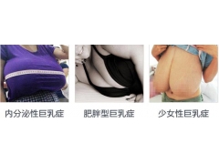 上海美萊乳房縮小術怎么樣