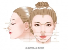 上海做線雕鼻子能保持多久