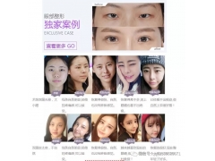 上海美萊修復雙眼皮厲害嗎