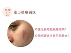 上海美容醫院做激光祛疤手術好不好