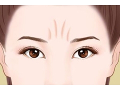 眉間紋一般用什么方法可以去除需要多少錢