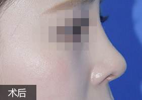 美萊藝塑鼻雕案例